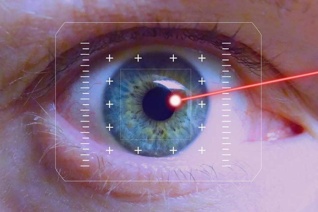 laserska operacija oči