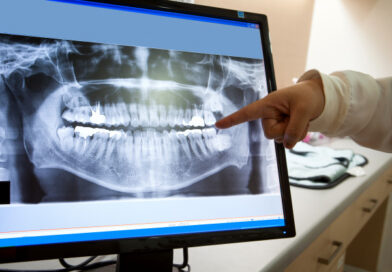 zobni rentgen